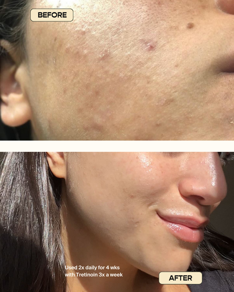 Trifecta Injection Trifecta Serum – Basic Principle